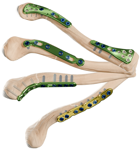 Upper Limb. - Newclip Technics